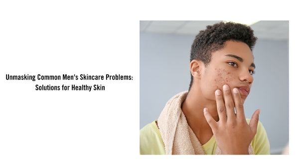 Unmasking Common Men's Skincare Problems: Solutions for Healthy Skin ...