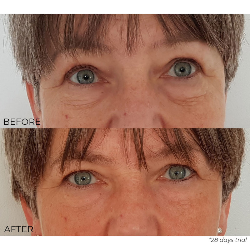 Anti Ageing Eye Cream Results
